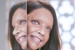 Deepika Padukone next film, Deepika Padukone new movie, first look of deepika padukone as acid attack survivor, Padmaavat