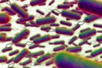 E.coli Outbreak deaths, E.coli Outbreak UK, all about e coli outbreak in the united kingdom, Manto