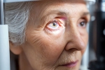 Glaucoma latest breaking, Glaucoma health experts, all about the eye disease glaucoma, Stress
