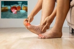 Gout Drugs on heart attack, Gout Drugs on heart attack, gout drugs may cut the risk of heart attack, Study Gout Drugs on heart attack, Gout Drugs on heart attack, gout drugs may cut the risk of heart attack, Study