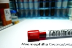 Hemophilia research, Hemophilia men, why are men likely to develop hemophilia, Episodes