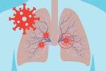 abnormalities, virus, how does covid 19 affect different parts of the body, Spanish flu