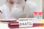 Zika Virus, FDA, fda expands zika screening to all us blood centers, Zika screening