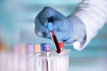 Pittsburg, antibodies, researchers discover an antibody that can cure covid 19 what is it, Human trials