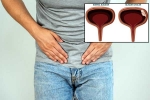 Bladder Cancer articles, Bladder Cancer articles, why is bladder cancer common in men, Gender bias